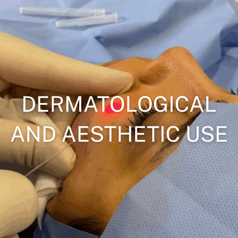 Ball tip surgical fibers application for dermatological and aesthetic use
