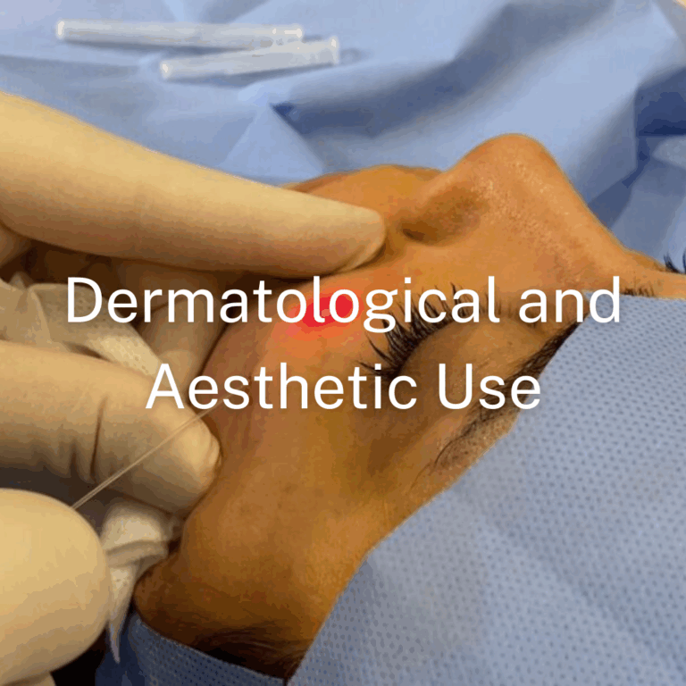 Radial Tip Fiber for Dermatology