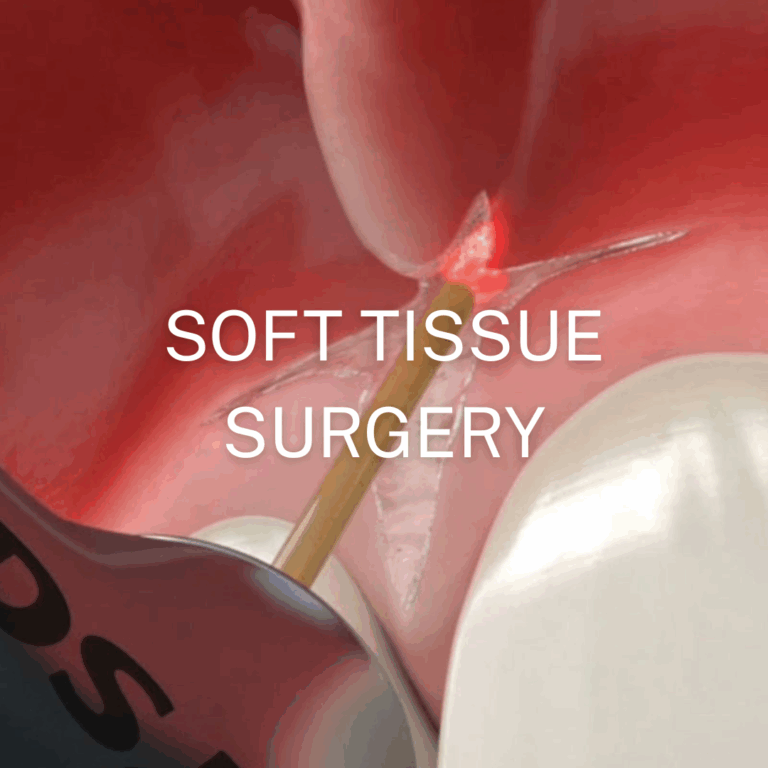 Superdry connectors for soft tissue surgery