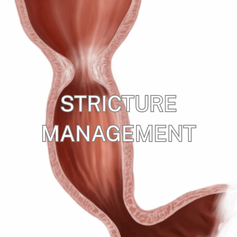 Stricture Management