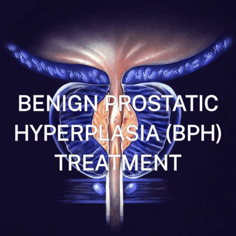 Thulium surgical fibers (100 micron) application for Benign Prostatic Hyperplasia