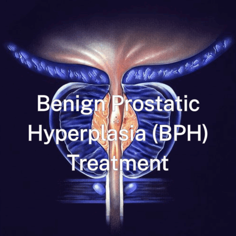 BHP Radial Tip Fiber Treatment