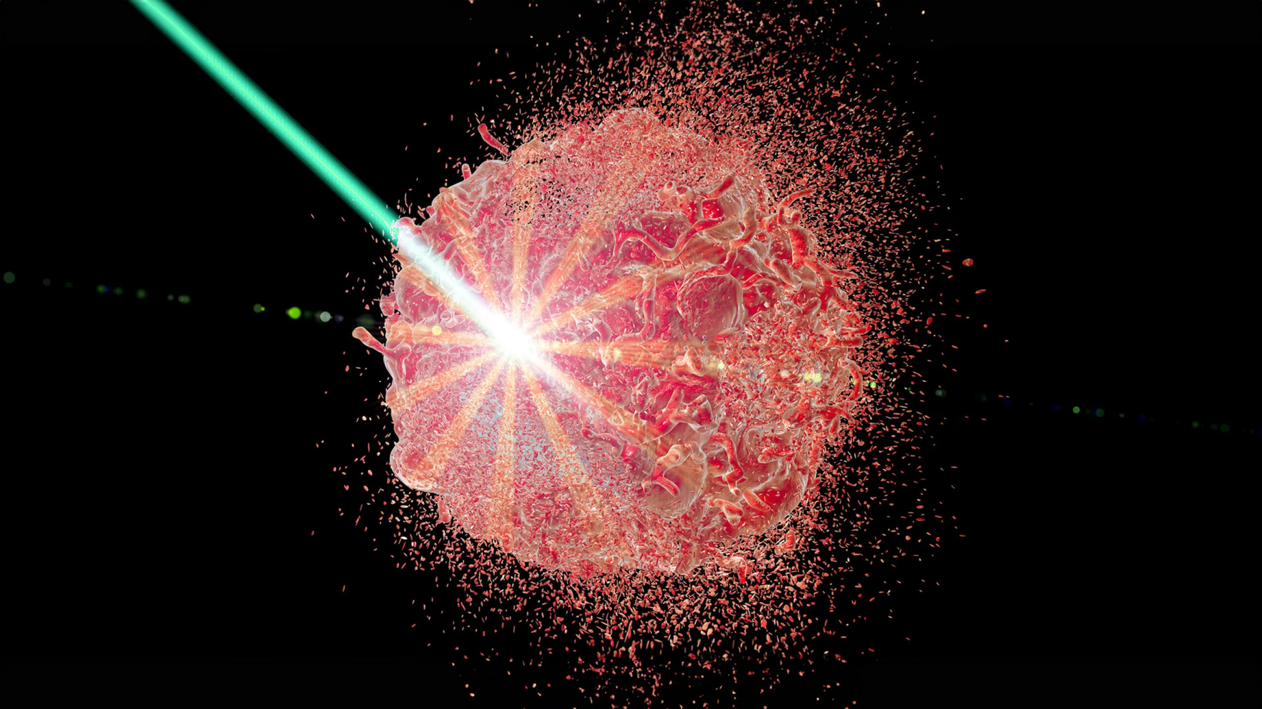 Image depicting Holmium Laser