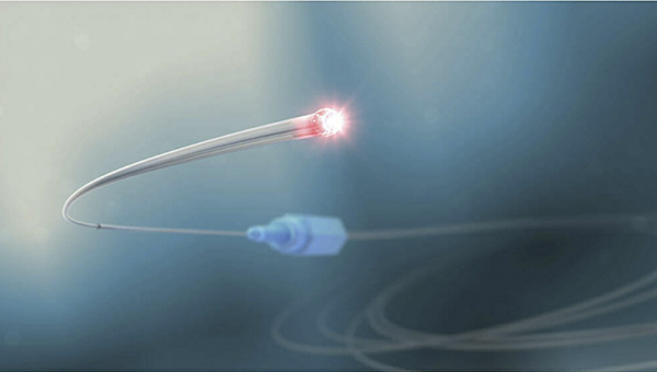 Sterile 200μm holmium laser fiber for surgical applications