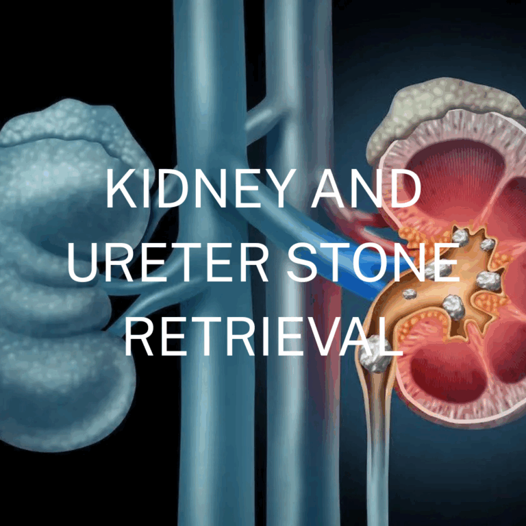 Kidney and Ureter Stone Retreival